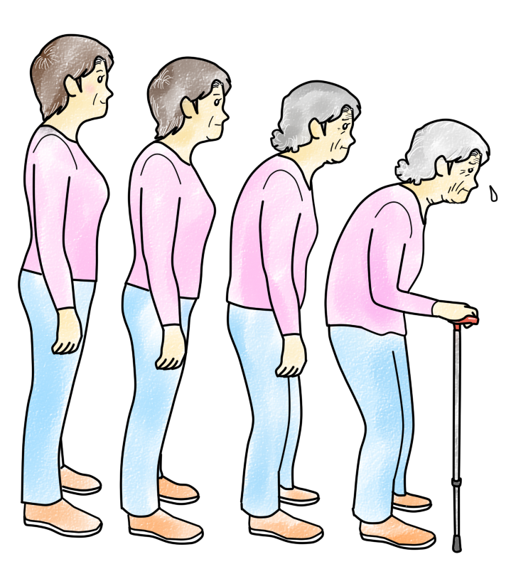加齢による姿勢 背骨の変化 腰 ひざ 肩 慢性的な痛み専門 要介護者 高齢者への訪問専門 いきいき鍼灸マッサージ治療院